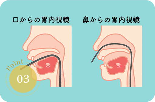 「オエッ」と嘔吐反射が苦痛な方へ 経鼻内視鏡検査にも対応